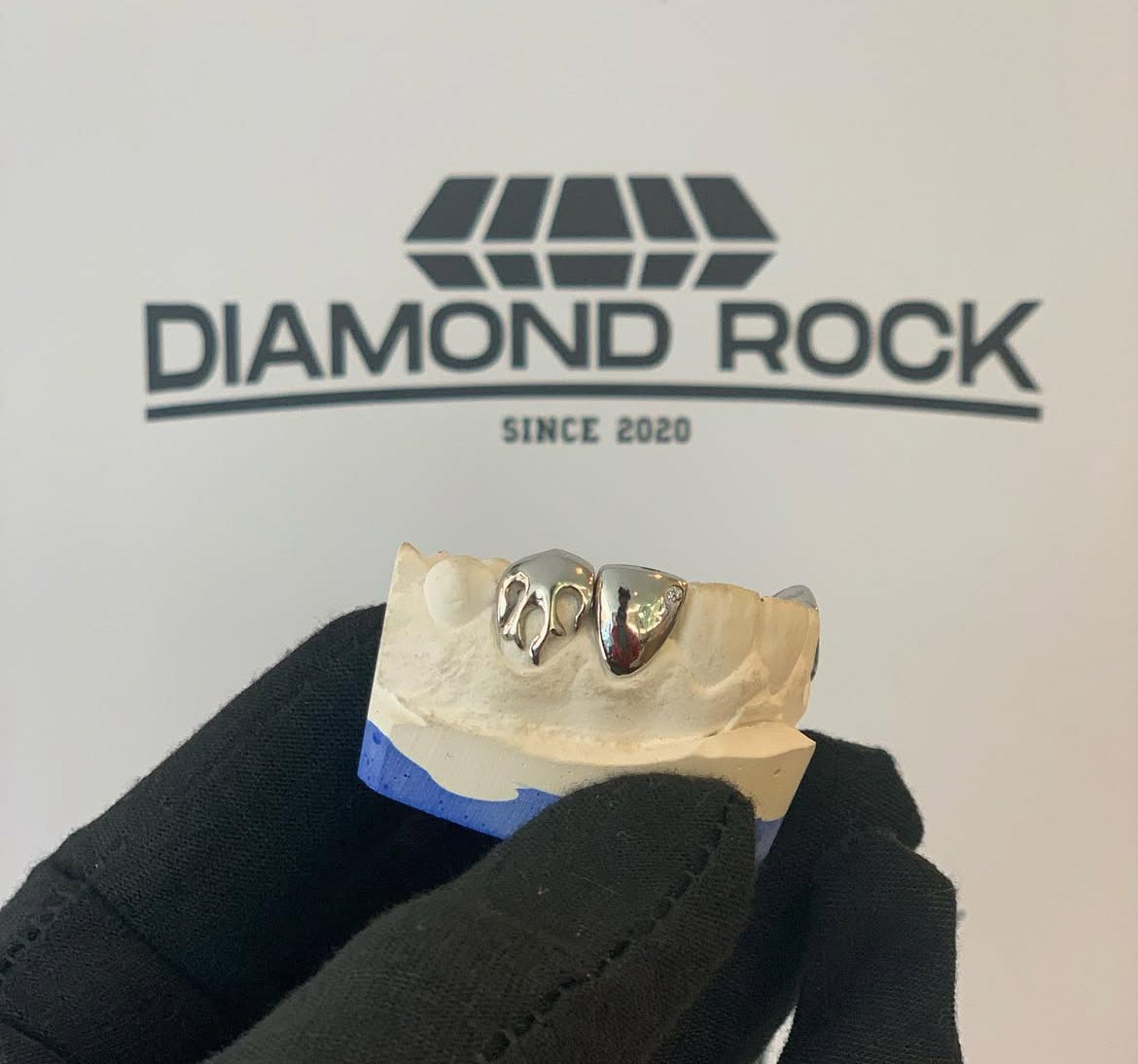 Comment commander un grillz à Toulouse sans se déplacer ?