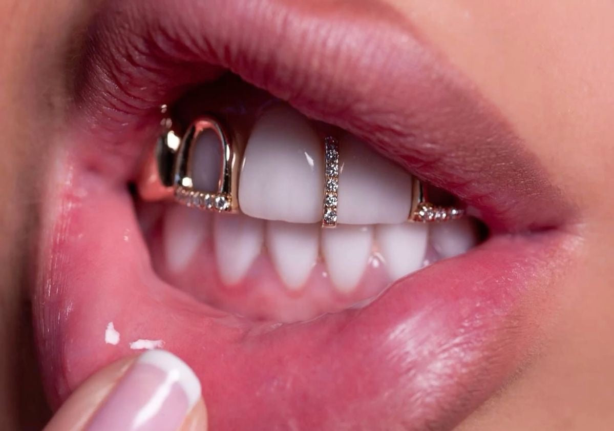 Grillz en France : Diamond Rock, le spécialiste du grillz sur mesure à distance