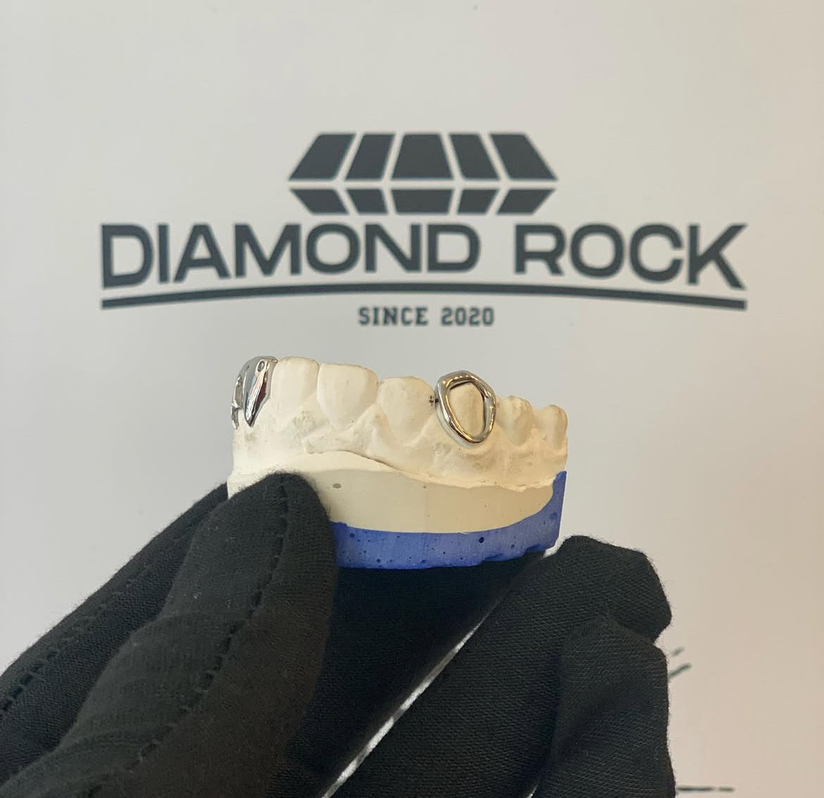 Grillz en France : la référence du grillz sur mesure, à distance et sans boutique