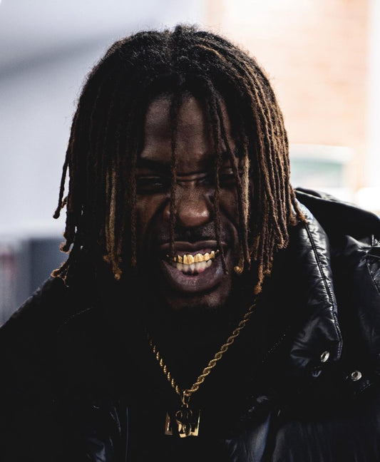 Les grillz en métal précieux - Une tendance en constante évolution
