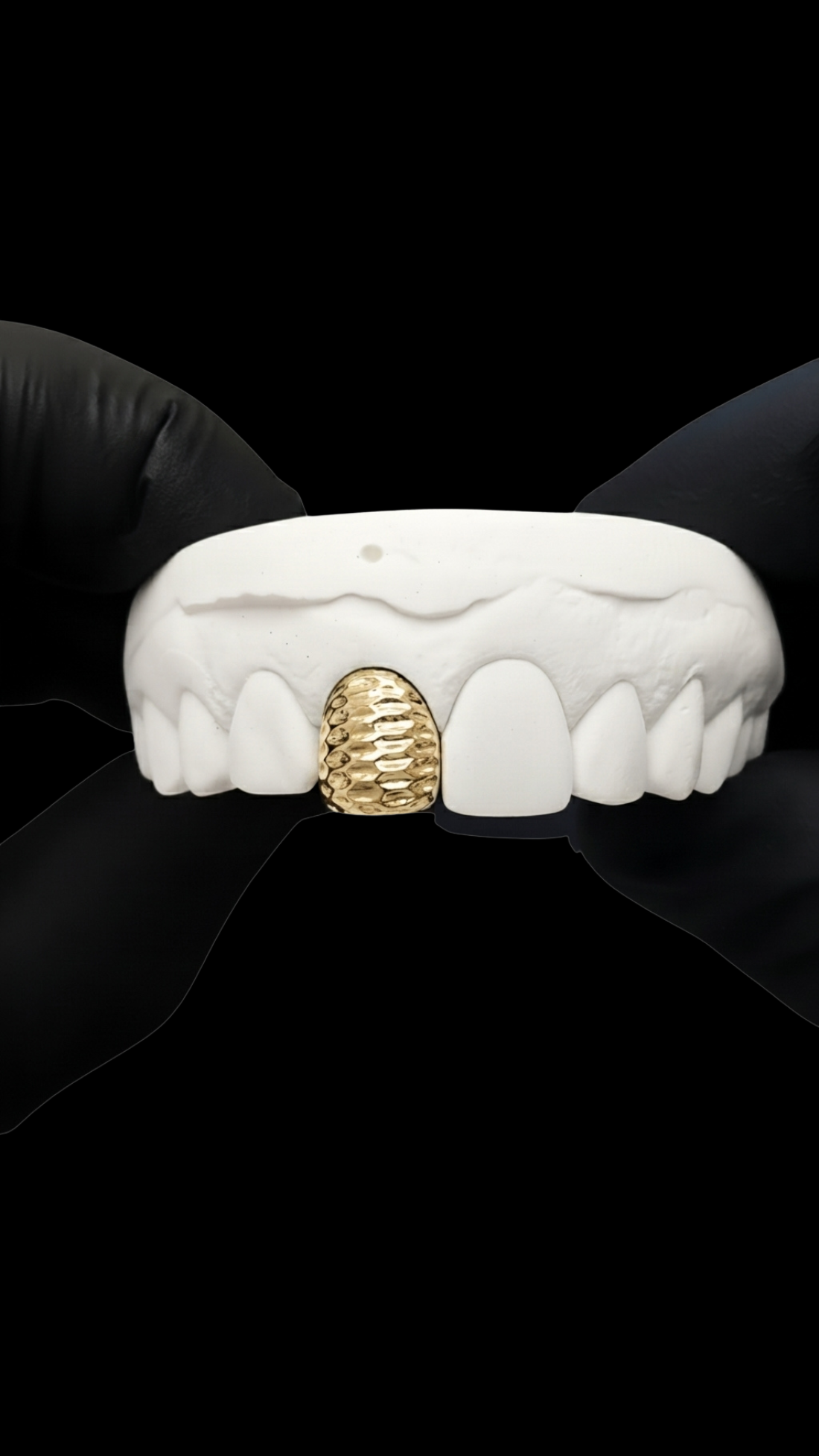 pineapple Grillz