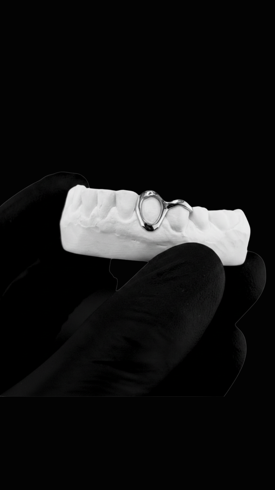 Open Face Grillz + Barre