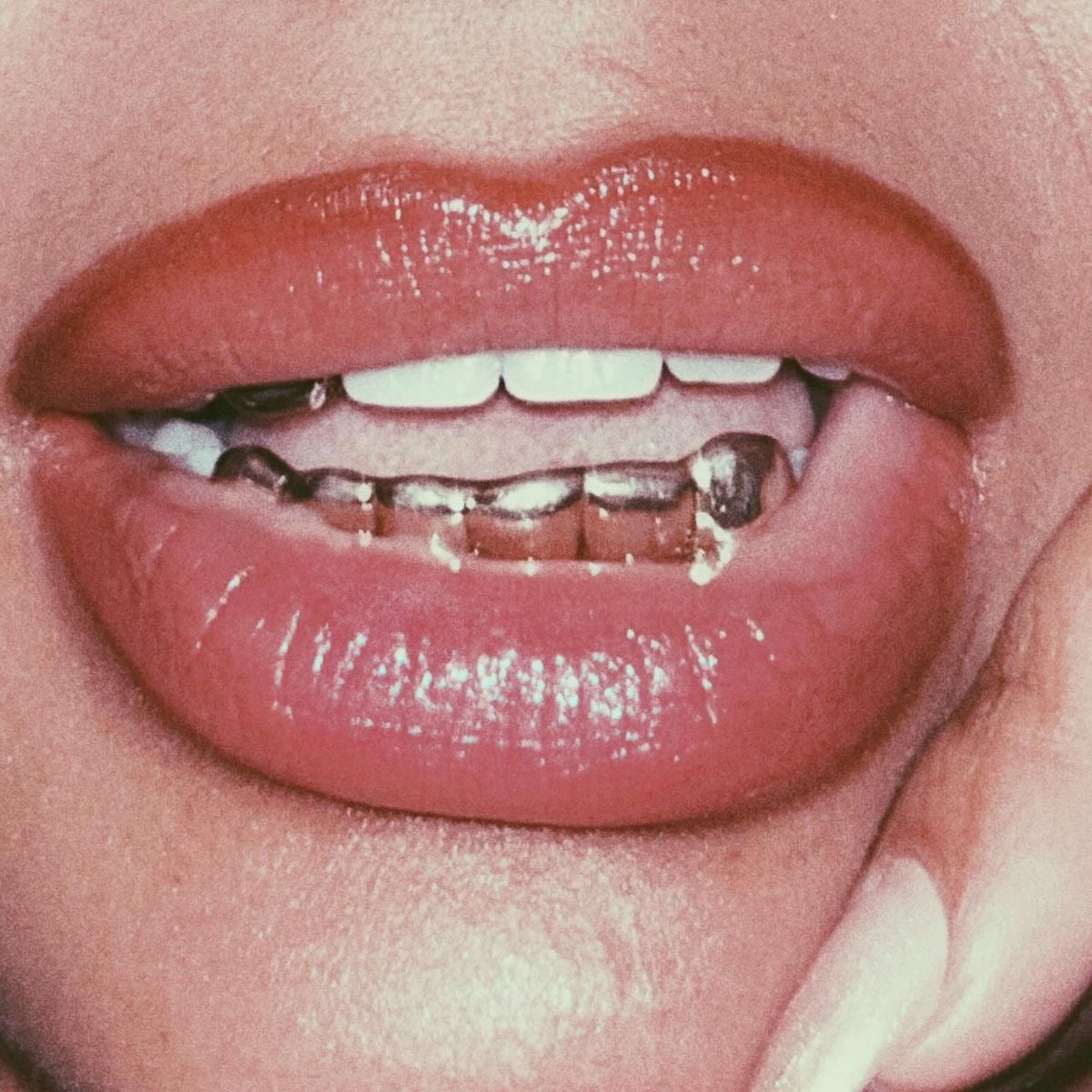 Grillz France | Grillz sur mesure à Paris, Lyon, Marseille, Toulouse, Bordeaux | Diamond Rock