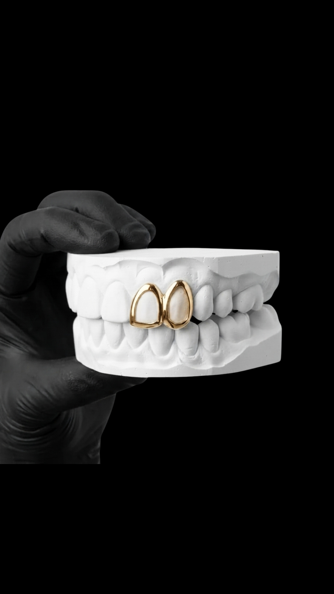 window classique grillz