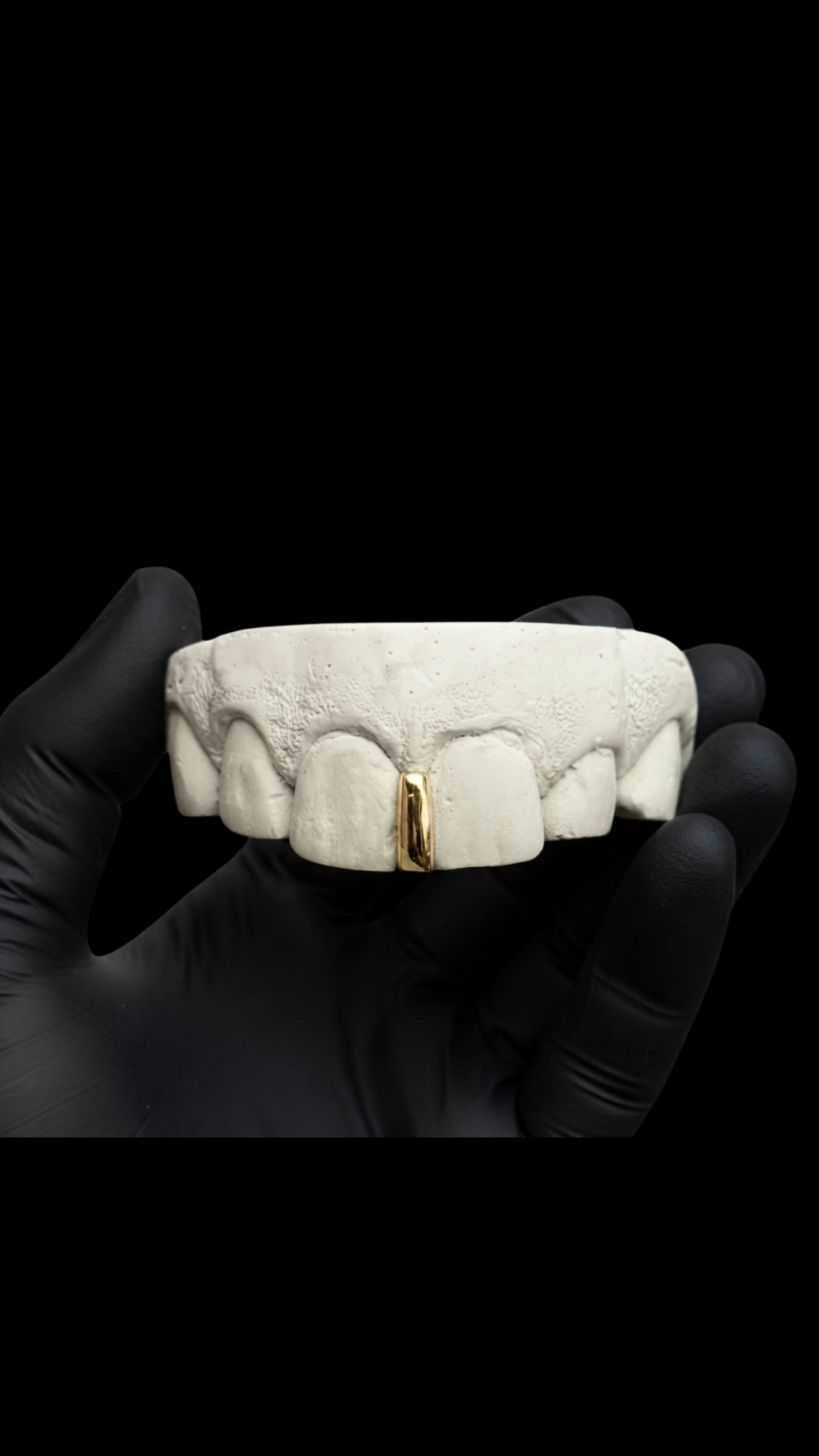 interstice Grillz