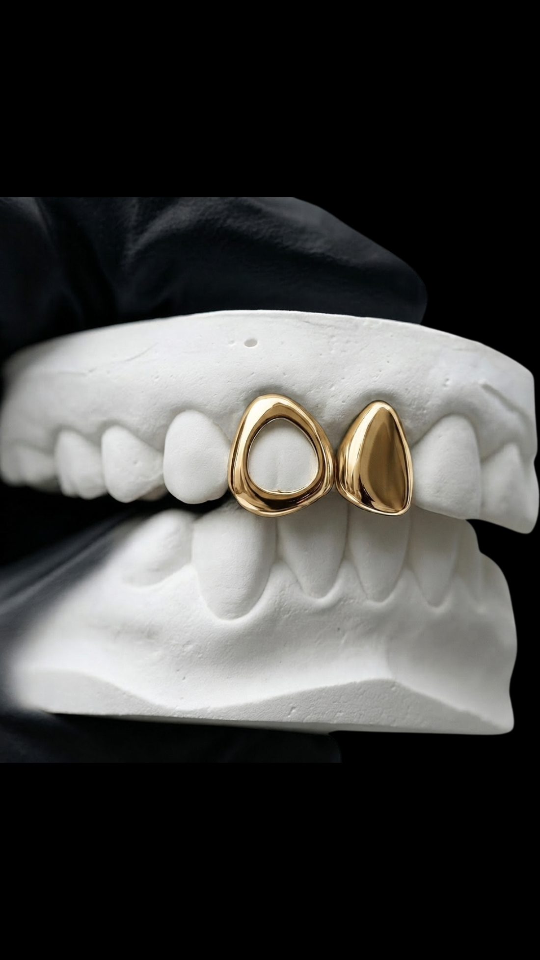 Open face & full grillz